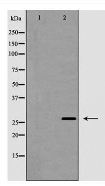 Polyclonal Rabbit anti-Human TNFSF13 / APRIL Antibody (IHC, IF, WB)