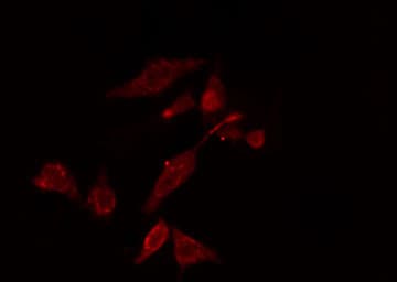Polyclonal Rabbit anti-Human RPS5 / Ribosomal Protein S5 Antibody (IF, WB)