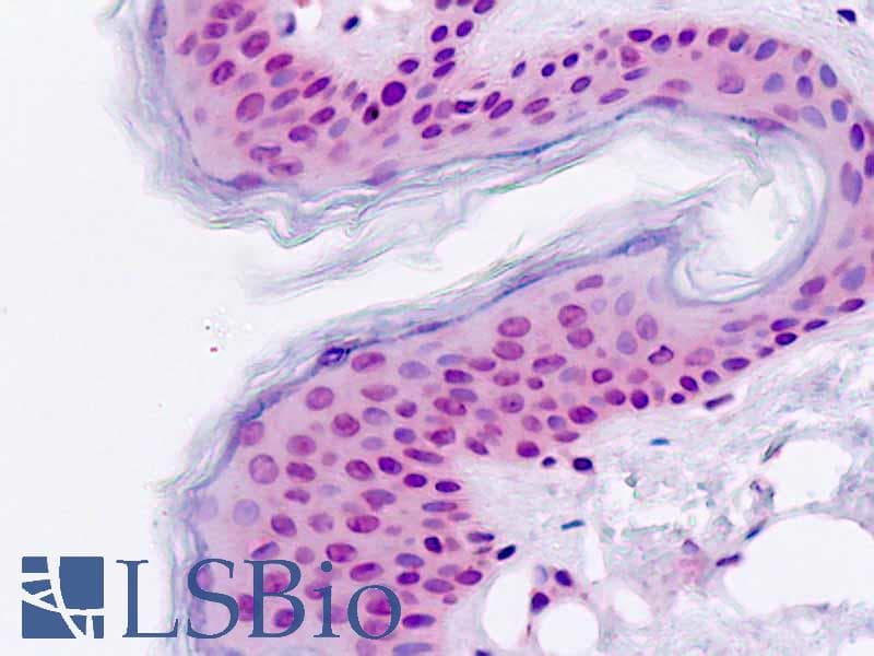 IHC-plus™ TGIF2 Antibody (aa171-199)