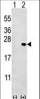 BID Antibody (aa68-103)
