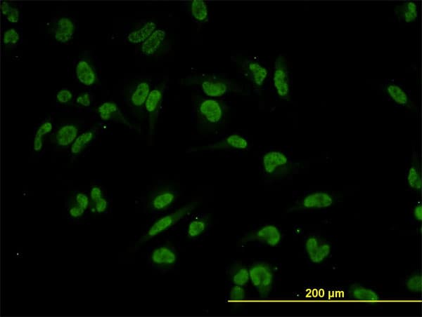 TRIM24 / TIF1 Antibody (clone 2F2)