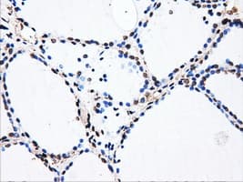 HDAC10 Antibody (clone OTI3C2)