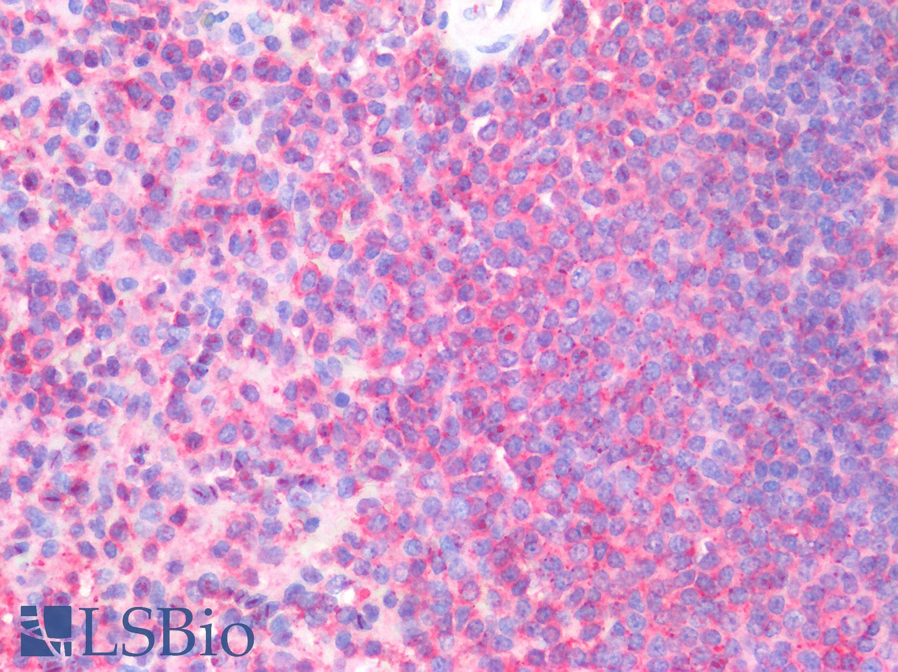 IHC-plus™ CFL1 / Cofilin Antibody (N-Terminus)