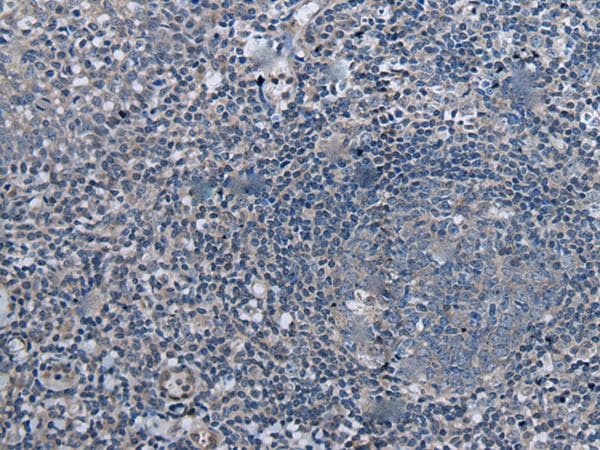 Polyclonal Rabbit anti-Human UBR4 Antibody (IHC)