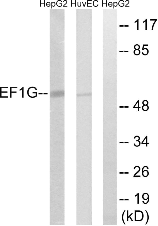 Polyclonal Rabbit anti-Human EF1G / EEF1G Antibody (aa101-150, WB)
