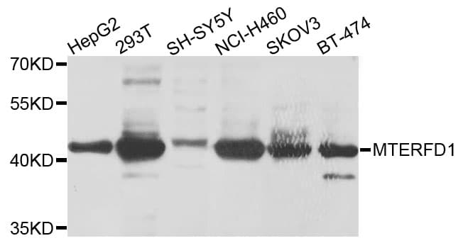 MTERF3 / MTERFD1 Antibody