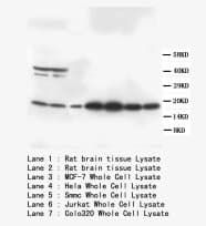 S100B / S100 Beta Antibody (C-Terminus)
