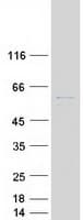 Human SLC41A3 Protein (Recombinant Myc-DDK (Flag))