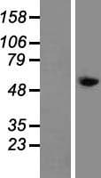 Human Tyrosine Aminotransferase Protein (Over-Expression Lysate Myc-DDK (Flag))