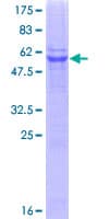 Human STX6 / Syntaxin 6 Protein (Recombinant GST)