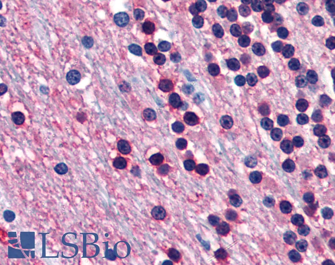 PathPlus™ Monoclonal Mouse anti-Human ENO2 / NSE Antibody (clone NSE-P1, IHC, WB)