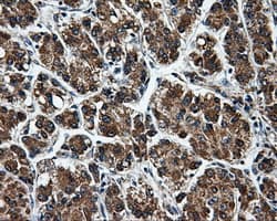 KIAA0153 / TTLL12 Antibody (clone OTI1A2)