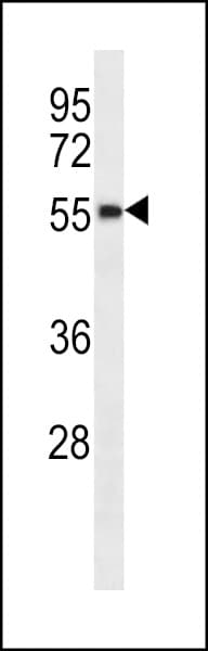 Polyclonal Rabbit anti-Human HSPC304 / C7orf64 Antibody (aa145-173, WB)