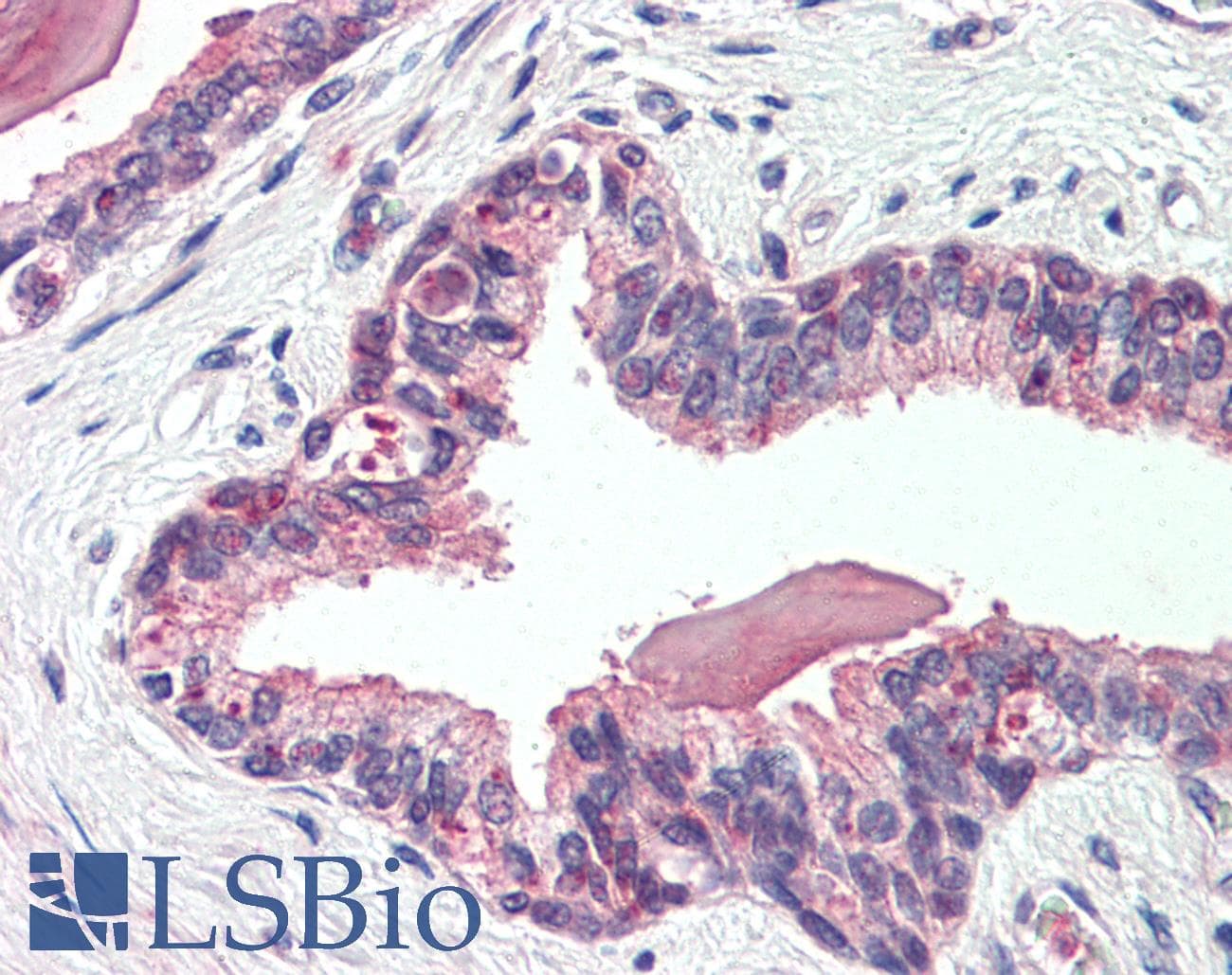 IHC-plus™ SLC12A2 / NKCC1 Antibody (Internal)