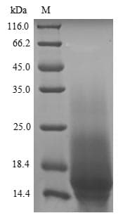 Parietaria judaica Par j 2.0101 Protein (Recombinant 6His, N-terminus)