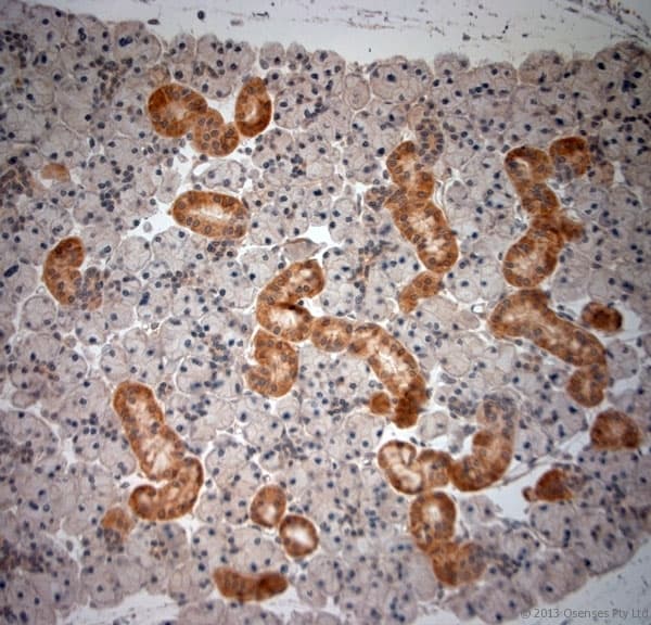 NGF Antibody (aa130-180)