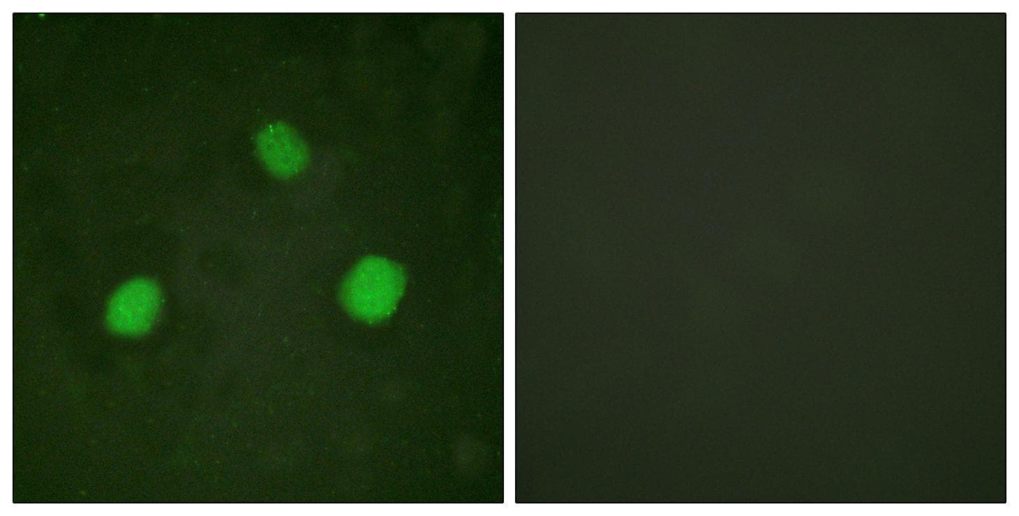 Histone H3.3 Antibody (phospho-Ser31)