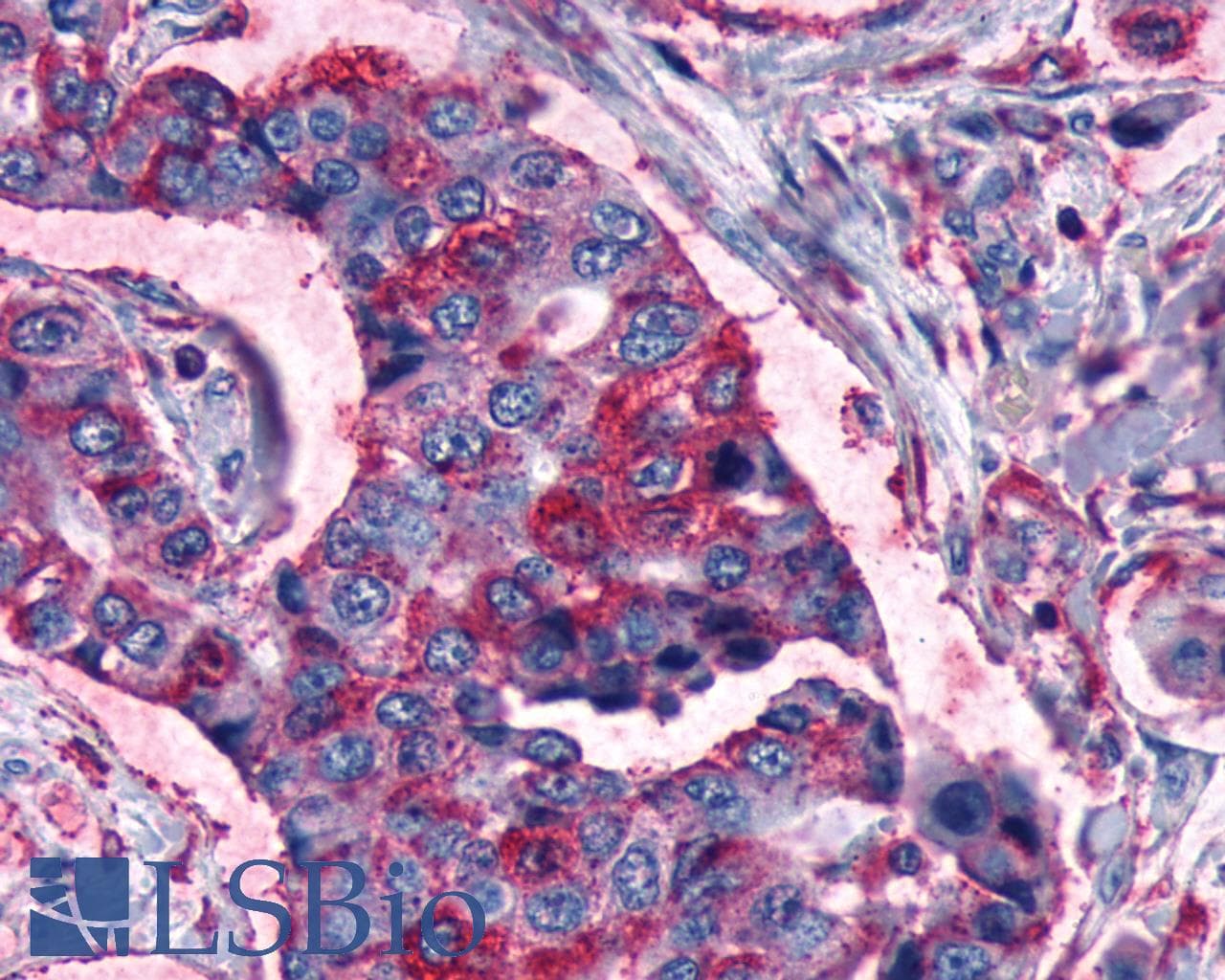 PathPlus™ Polyclonal Rabbit anti-Human FZD3 / Frizzled 3 Antibody (IHC)