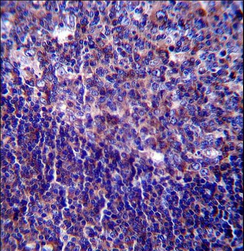 Polyclonal Rabbit anti-Human CD5 Antibody (aa203-232, IHC, WB)