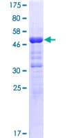 Human ANKRD49 Protein (Recombinant GST)