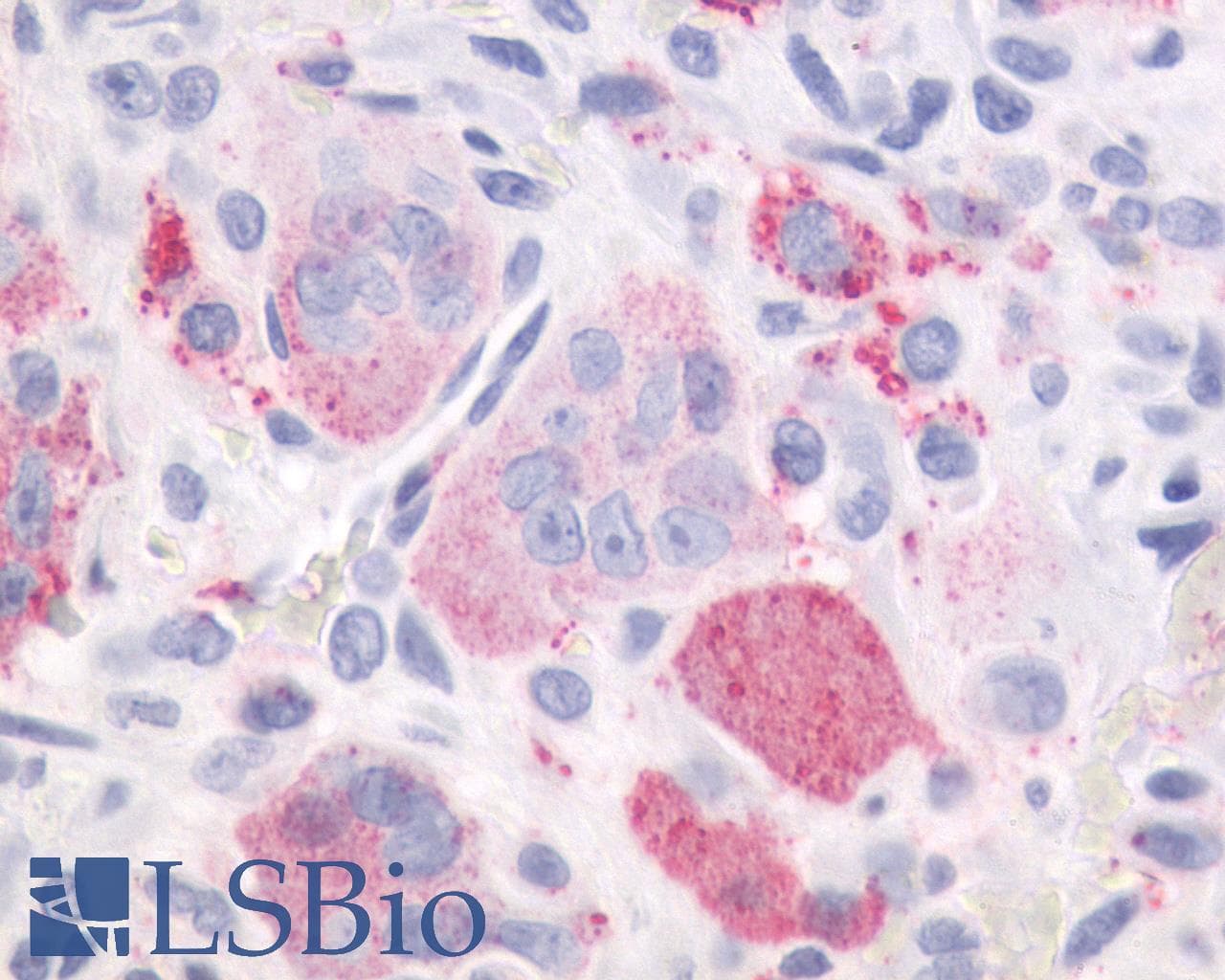 IHC-plus™ PTHR / PTHR1 Antibody (Internal)