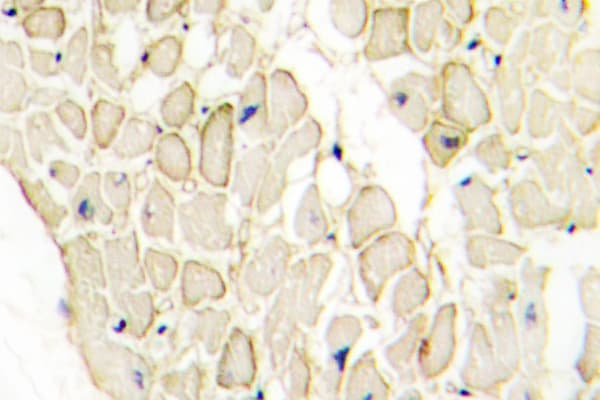 Polyclonal Rabbit anti-Human CDH13 / Cadherin 13 Antibody (Met352, IHC, IF, WB)