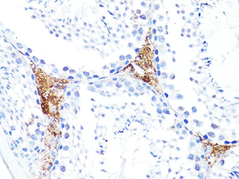 Polyclonal Rabbit anti-Human S100A10 Antibody (IHC, WB)
