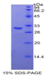 Human Neurofascin / NF Protein (Recombinant His)