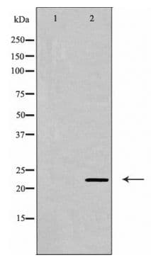 CLDN6 / Claudin 6 Antibody