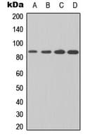 IKBKB / IKK2 / IKK Beta Antibody (Internal)