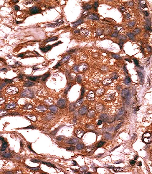 GUCY1A1 / GUCY1A3 Antibody (aa269-300)