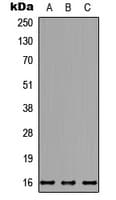 Polyclonal Rabbit anti-Human NDUFB7 / B18 Antibody (Internal, WB)