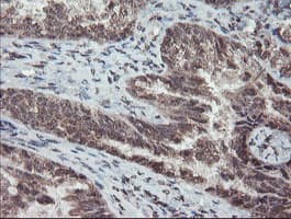 TDO2 Antibody (clone OTI2A4)
