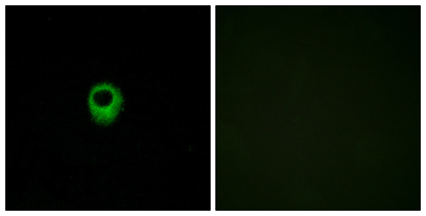 Polyclonal Rabbit anti-Human LPAR2 / EDG4 Antibody (aa271-320, IF, WB)