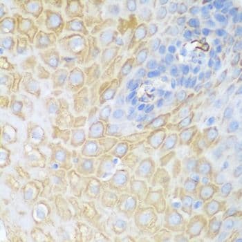 CDK1 / CDC2 Antibody