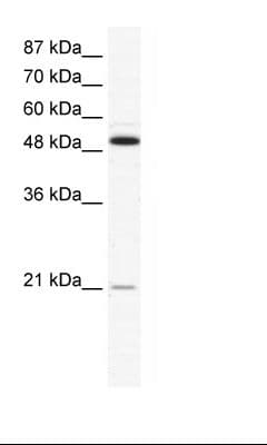 OPG / Osteoprotegerin Antibody (N-Terminus)