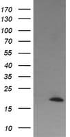 CTAG1B / NY-ESO-1 Antibody (clone OTI2A10)