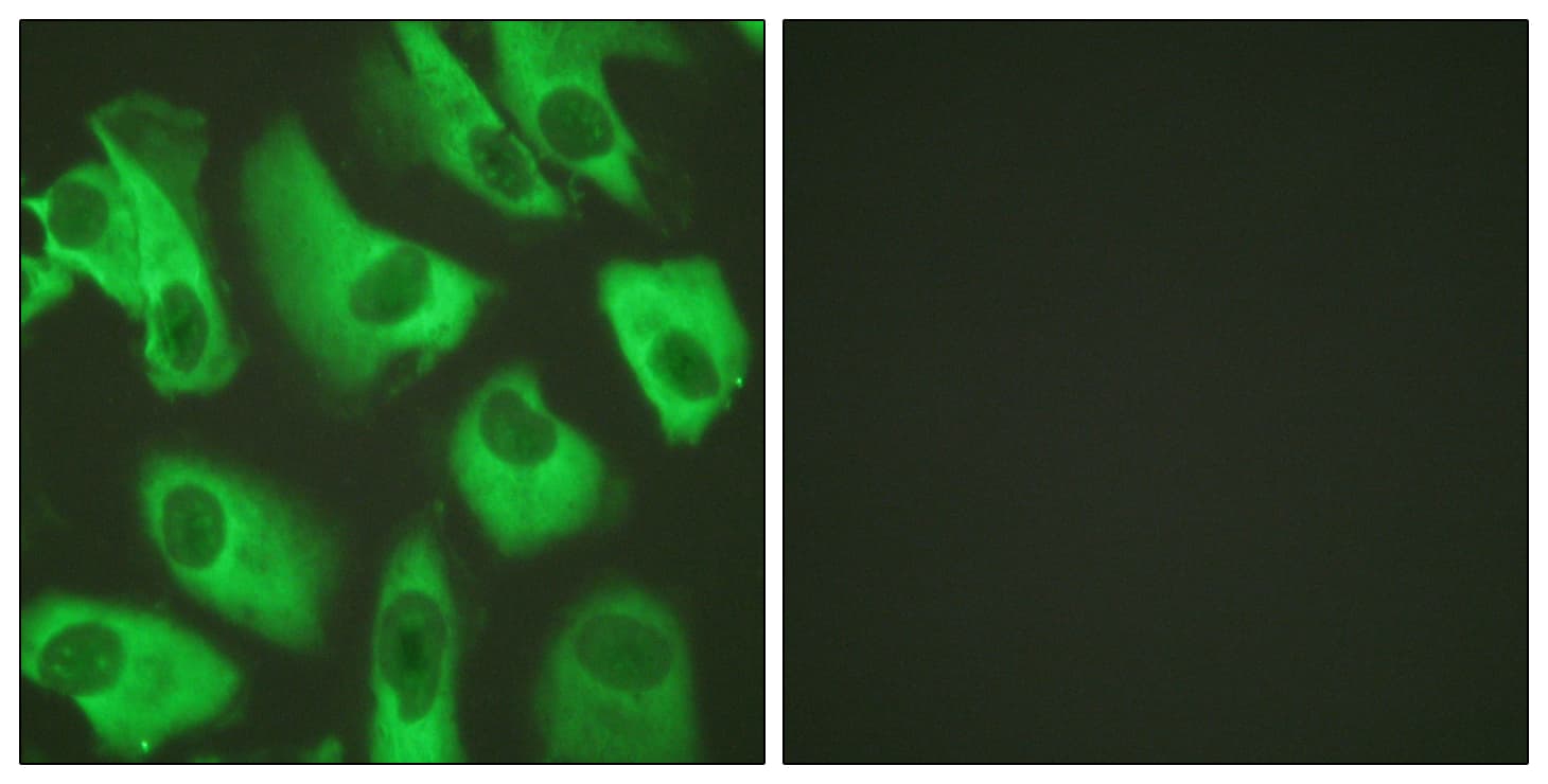 IHC-plus™ KCNJ16 / Kir5.1 Antibody (aa369-418)