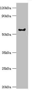 Polyclonal Rabbit anti-Human GRK6 Antibody (aa1-170, IHC, WB)