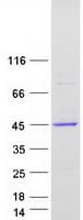 Human FCGRT / FCRN Protein (Recombinant Myc-DDK (Flag))