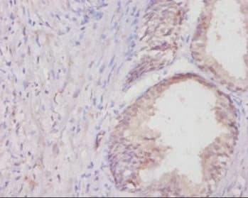 Polyclonal Rabbit anti-Rat COL1A1 / Collagen I Alpha 1 Antibody (IHC)