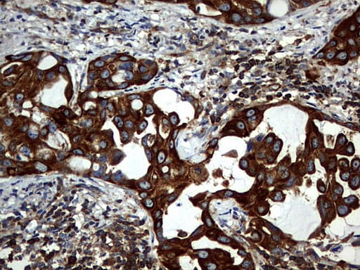Monoclonal Mouse anti-Human KRT7 / CK7 / Cytokeratin 7 Antibody (clone OTI3B7, IHC, WB)