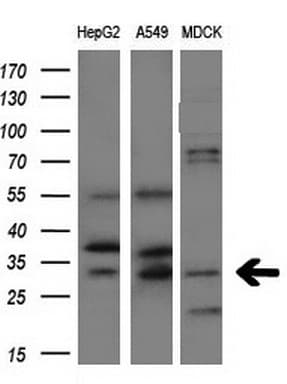 IHC-plus™ AQP1 / Aquaporin 1 Antibody (clone OTI2D10)