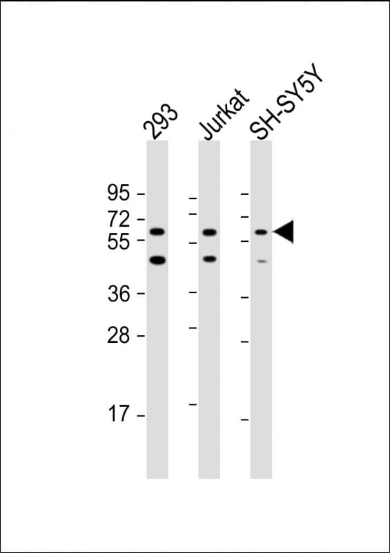 HEXDC Antibody (N-Terminus)