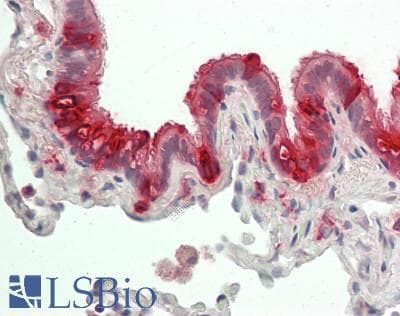 Polyclonal Rabbit anti-Human SCGB1A1 / Uteroglobin Antibody (aa23-91, IHC, WB)