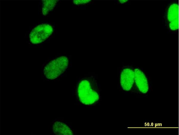 CTNNBL1 / NAP Antibody (clone 5F1)