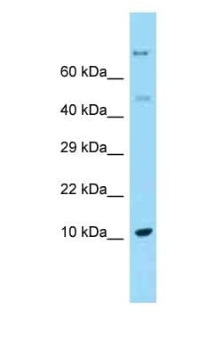REG1A Antibody (C-Terminus)