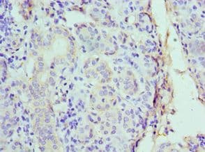 CST1 / Cystatin SN Antibody (aa20-141)