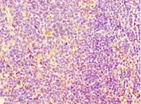 IHC-plus™ SRRT / ARS2 Antibody (aa627-876)