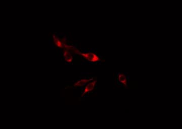 Polyclonal Rabbit anti-Human ACBD6 Antibody (IF, WB)